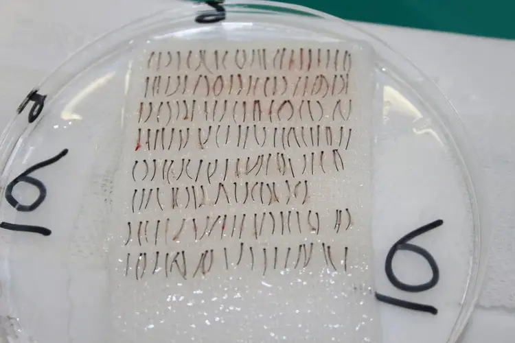 Les racines de la barbe